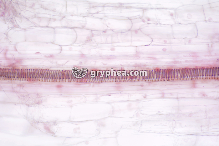 Vaisseaux spiralés Poireau x40 - gryphea.com